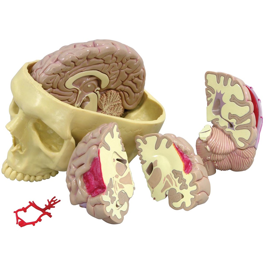 Brain Model