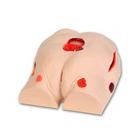 [3BS1009798] Seymour II Wound Care Model